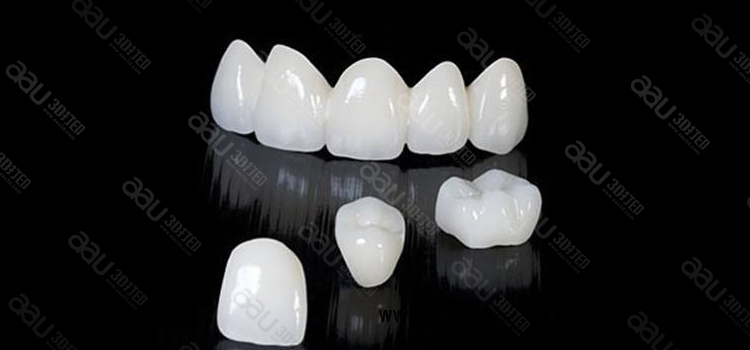 細(xì)節(jié)圖1 (3).jpg 3D打印鈷鉻合金烤瓷牙