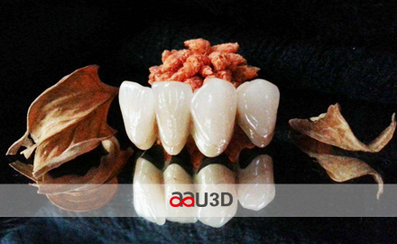 鈷鉻合金3D打印